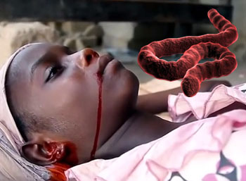 مریض ایبولا