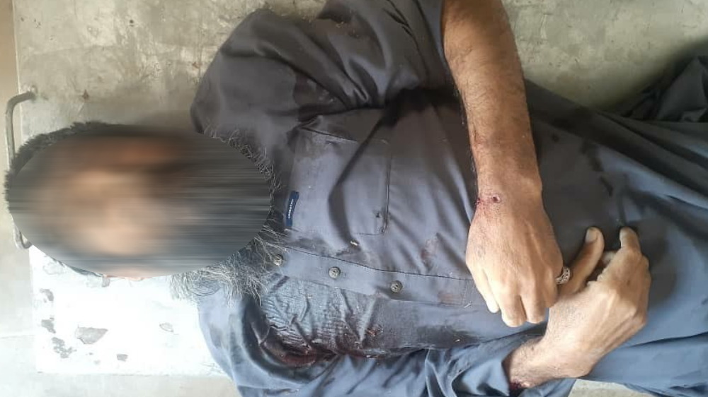 جسد مرد قصاص‌شده توسط طالبان در فراه
