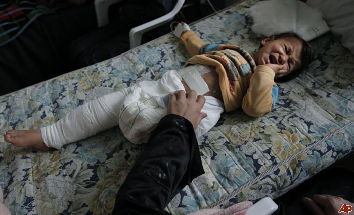 دختر زخمی لیبی