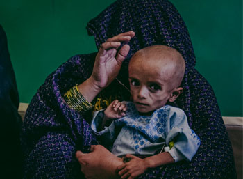 کودکان افغان قربانیان اصلی جنگ»